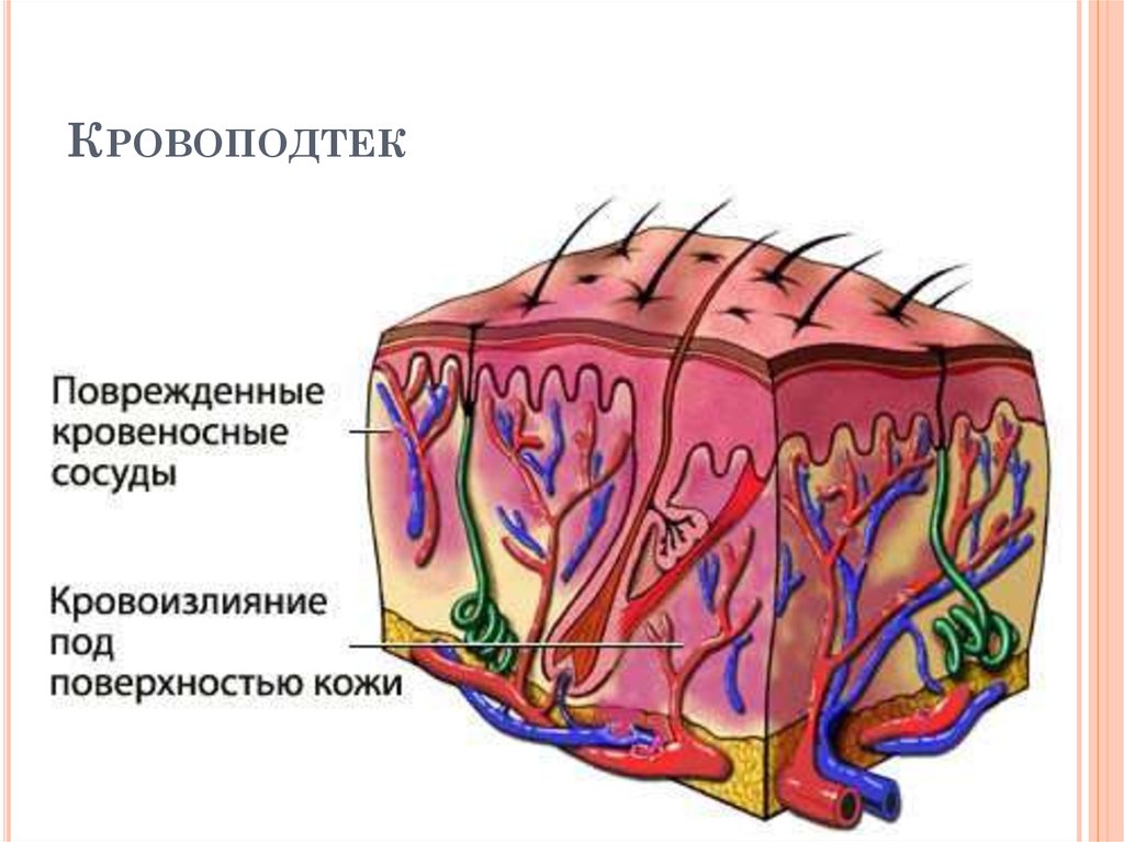 Кровеносные сосуды кожи. Гематома (кровоизлияние под кожу). Подкожные кровоподтеки.