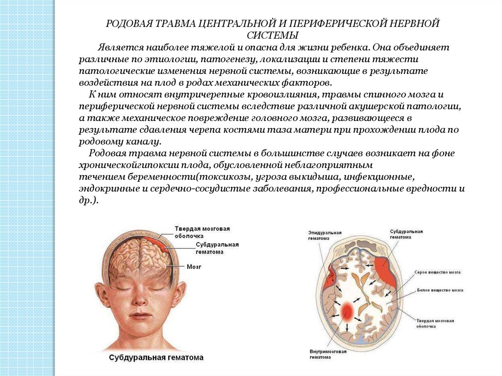 Центральная нервная система новорожденного. Родовые травмы новорожденных. Внутричерепная родовая травма. Родовая травма головного мозга.