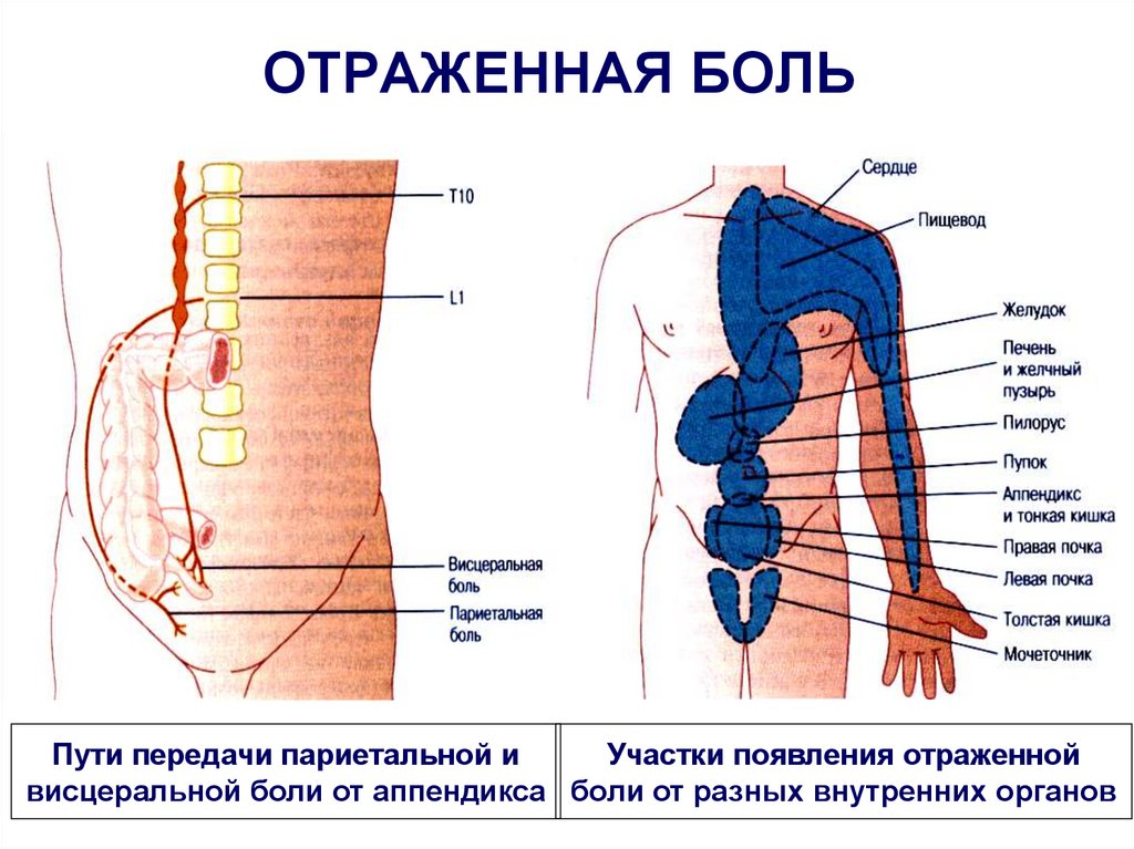 Болама болам