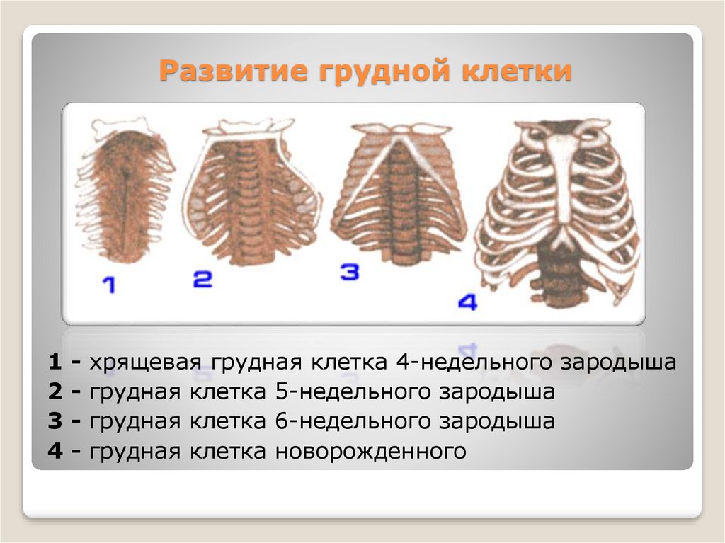 Рахитическая грудная клетка рисунок схематично