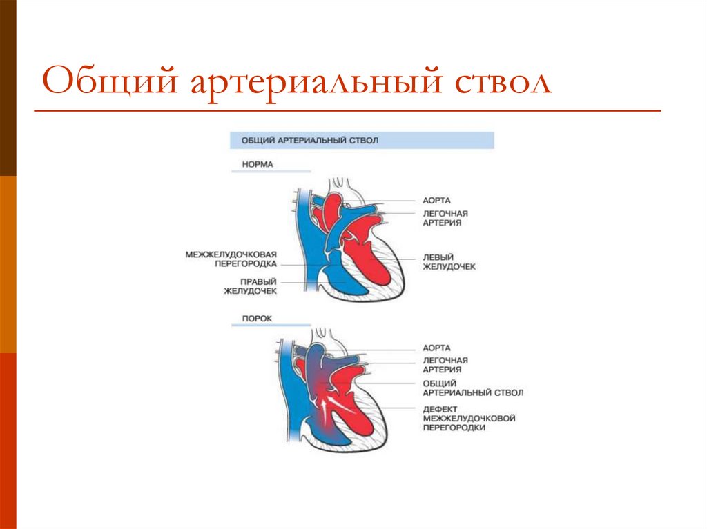 Легочная артерия отходит от