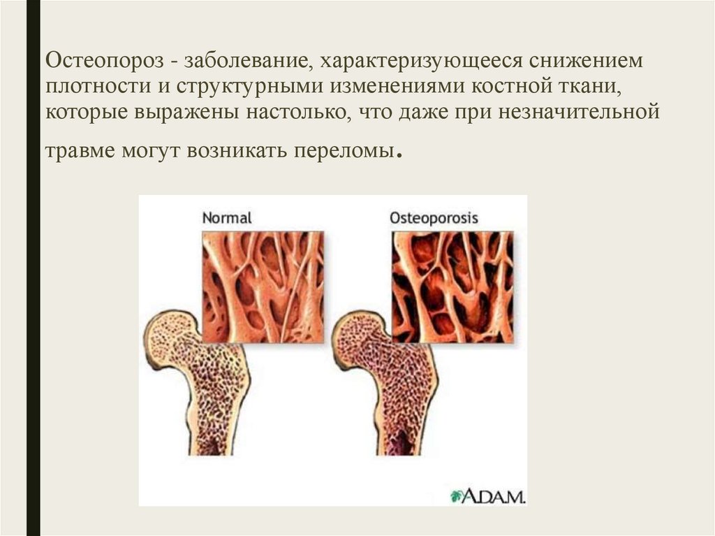 Центр остеопороза