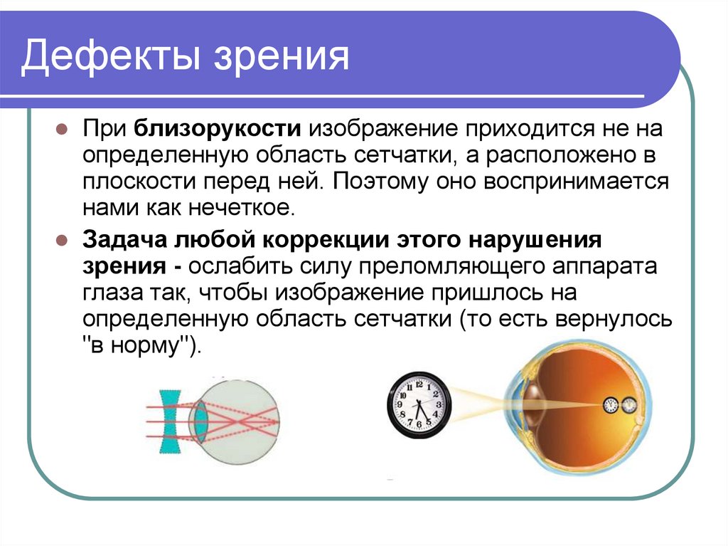 При близорукости изображение предмета возникает