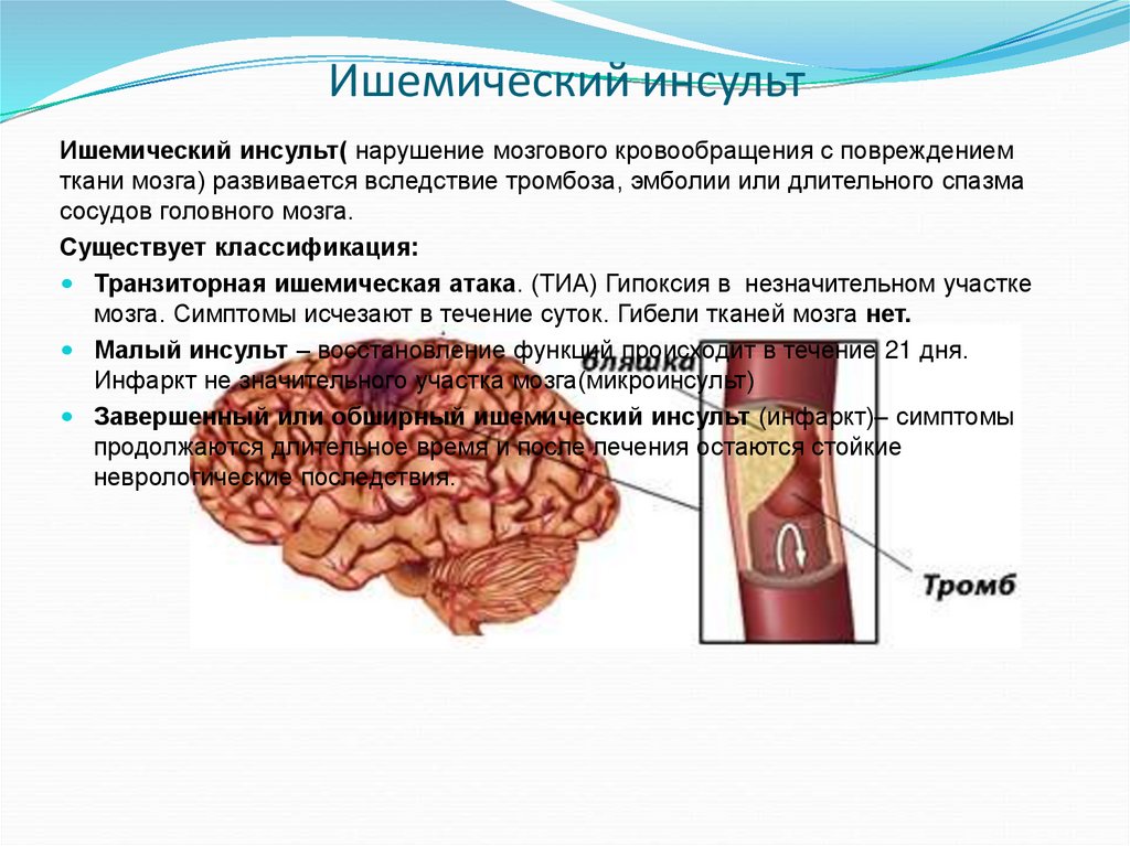 Ишемический инсульт головного мозга. ОНМК ишемический инсульт. Острое нарушение мозгового кровообращения презентация. Ишемический инсульт презентация.