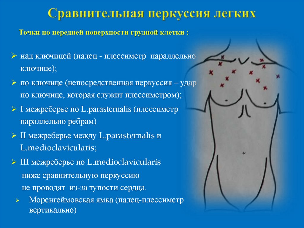 Точки на груди. Перкуссия грудной клетки пропедевтика точки. Топографическая перкуссия легких точки. Сравнительная перкуссия грудной клетки алгоритм. Сравнительная перкуссия лёгких точки.