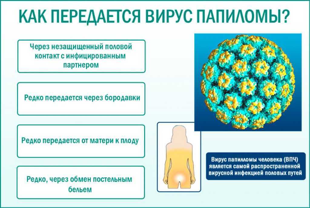 Можно ли забеременеть с впч