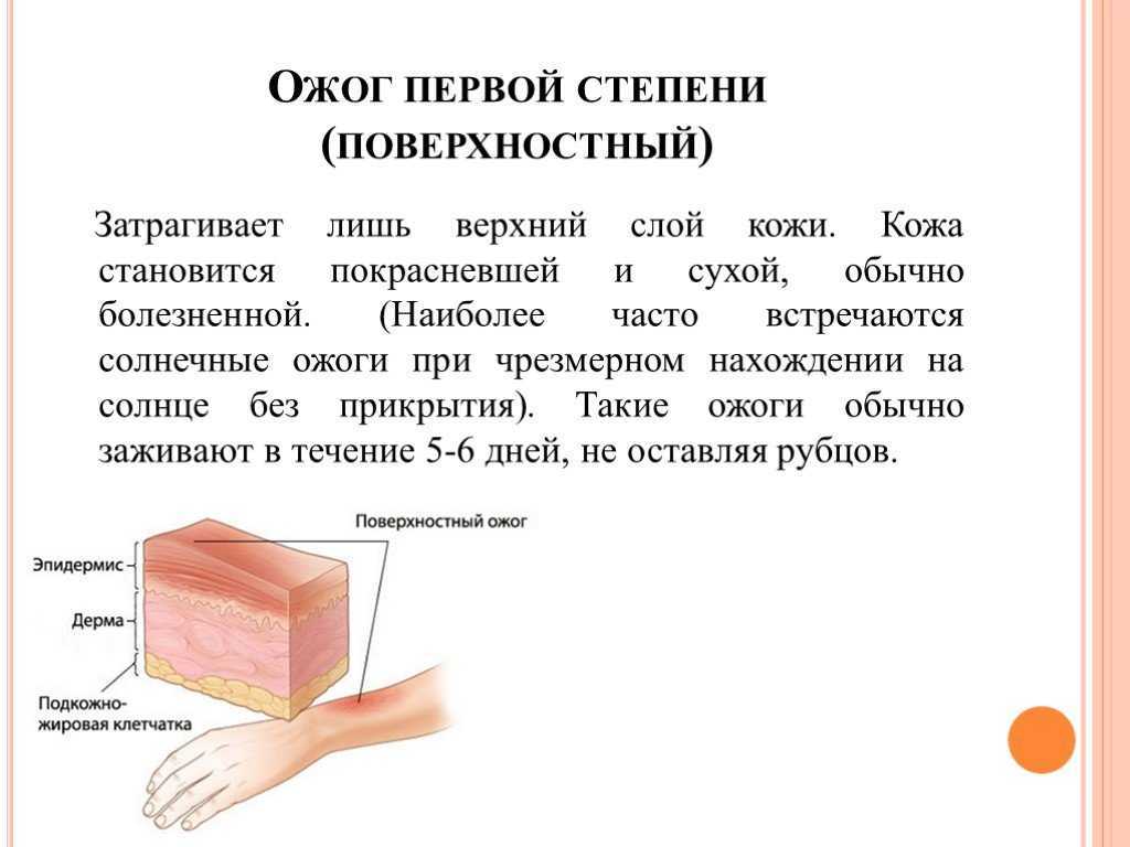 Сколько проходит ожог