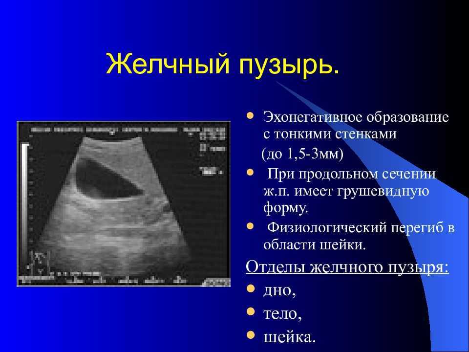 Желчный пузырь размеры норма. Ультразвуковое исследование желчный пузырь норма. Перегиб желчного пузыря УЗИ. S образный желчный пузырь УЗИ. Перегиб желчного пузыря УЗИ признаки.