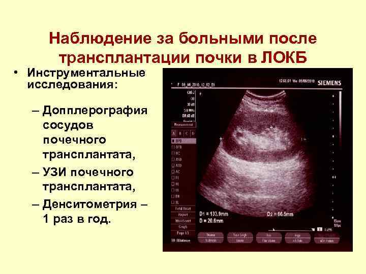 Узи сосудов почек подготовка к исследованию