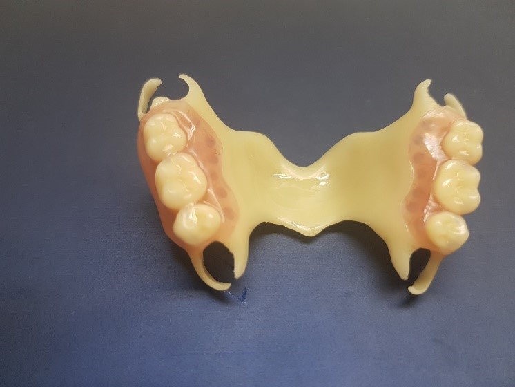 Зубной протез бабочка фото на верхнюю челюсть фото