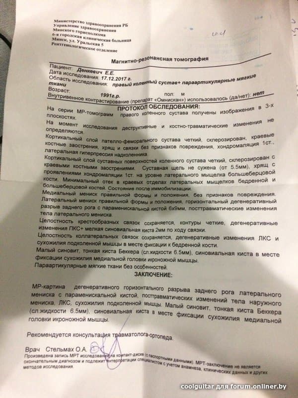 Застарелое повреждение менисков мкб. УЗИ при повреждении мениска протокол. Мрт разрыв мениска-заключение. Протокол операции. Разрыв мениска коленного сустава на УЗИ.