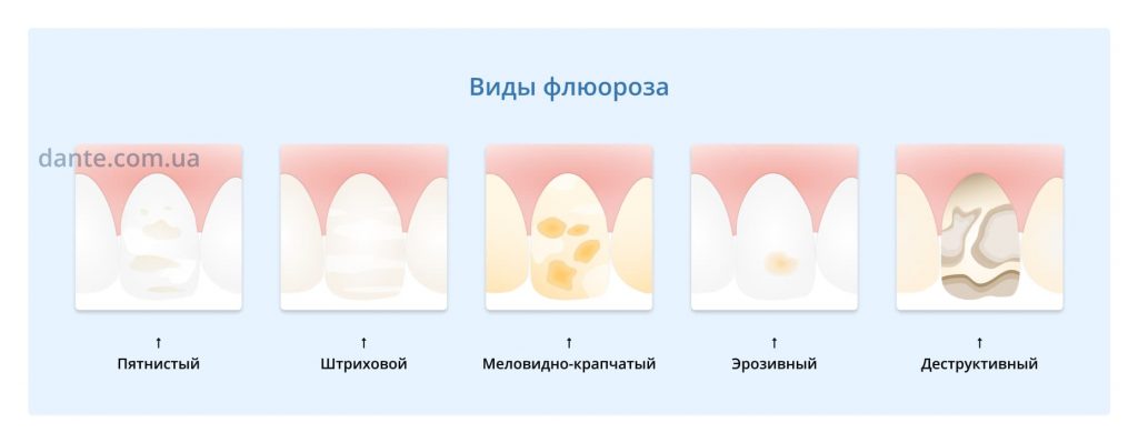 Начальный Кариес У Детей Фото