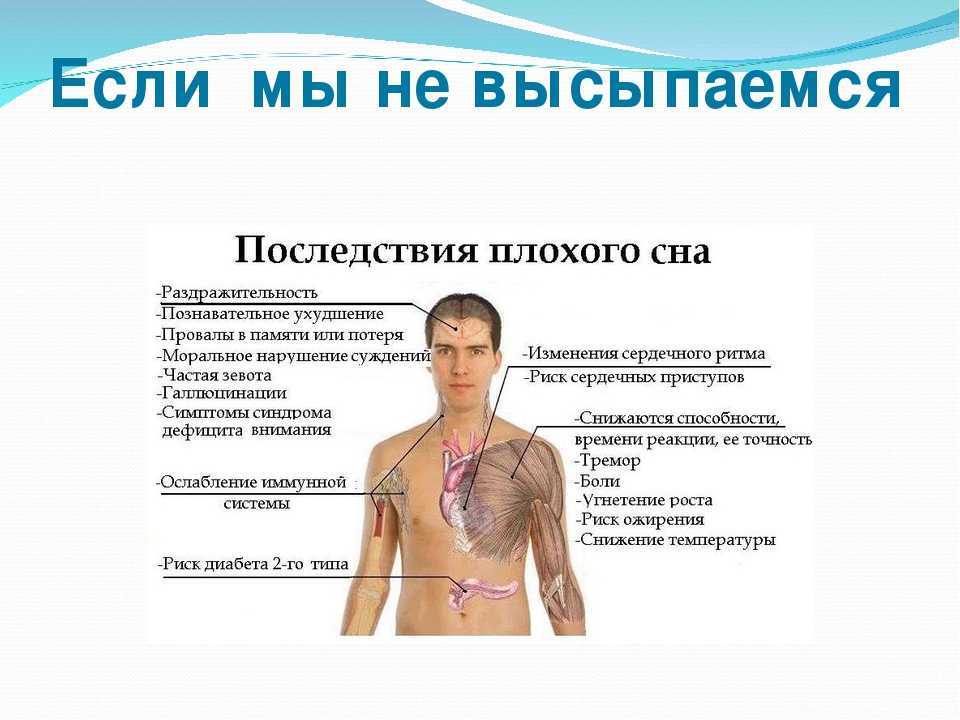 Какие последствия изменения. Последствия нарушения сна. Признаки недосыпа. Если не высыпаться последствия. Влияние недосыпания на организм человека.