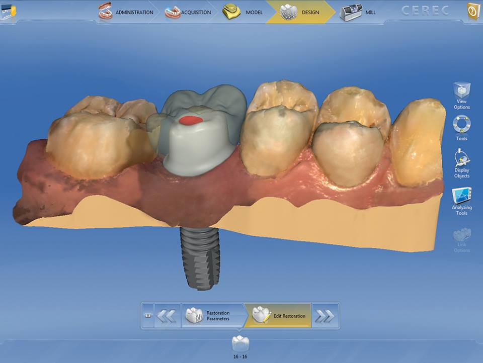 Технология изготовления cerec коронки презентация