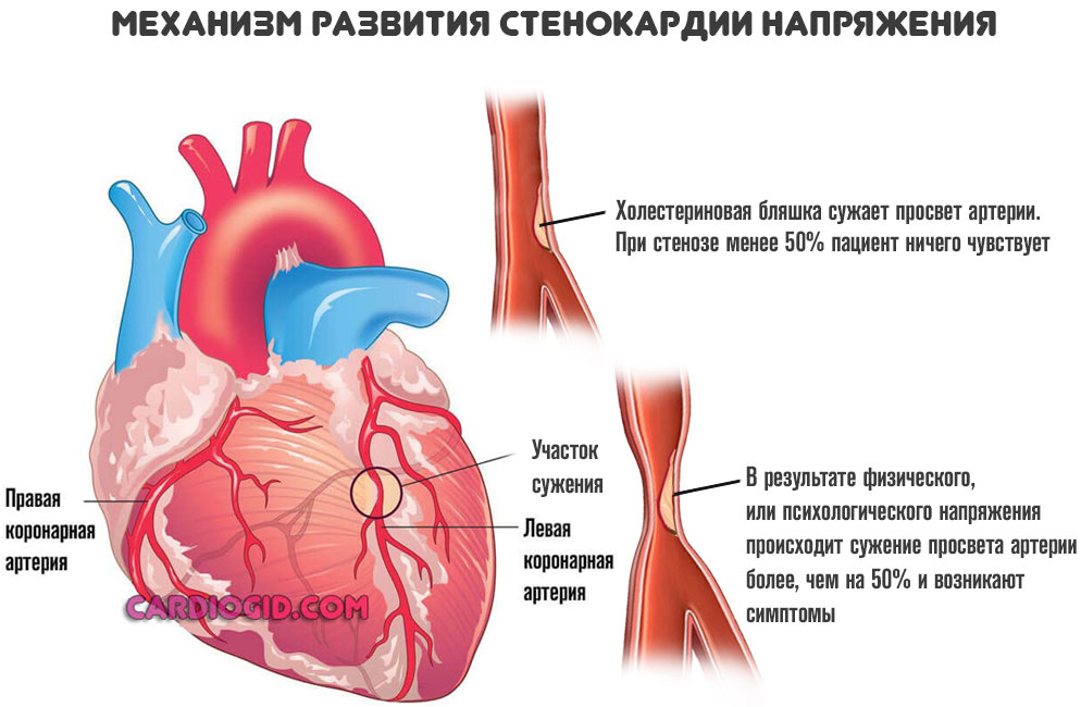 Сердечная мышца где находится у человека фото признаки и лечение