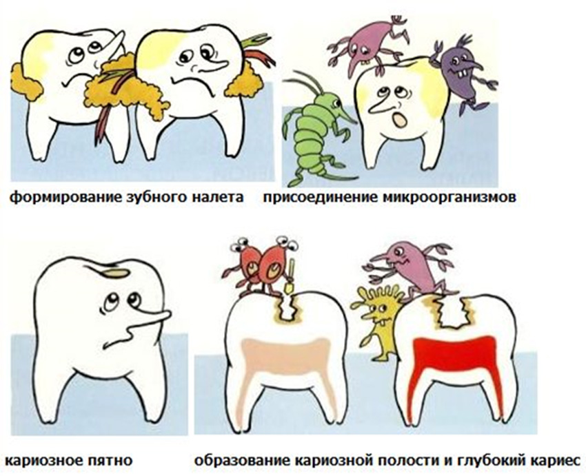 Кариес картинки для детей кариес