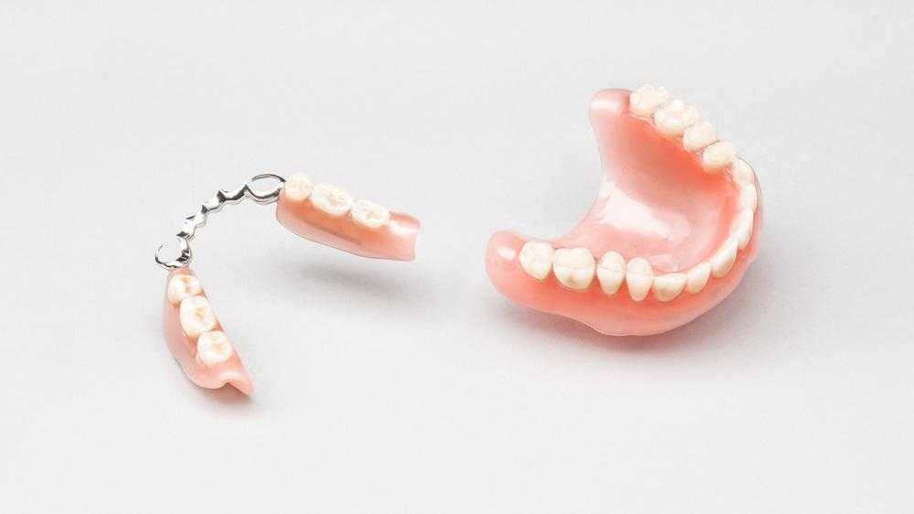 Съемный протез зубов какие бывают. Съемный микропротез 1 зуб. Несъемные зубные протезы.