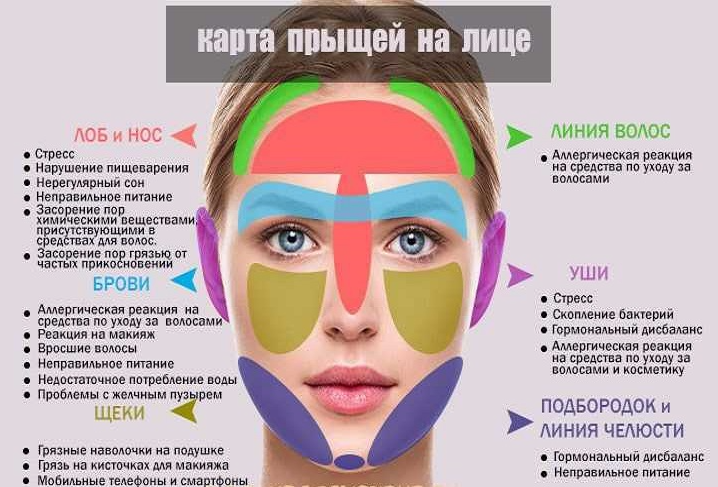 Почему появляются прыщи