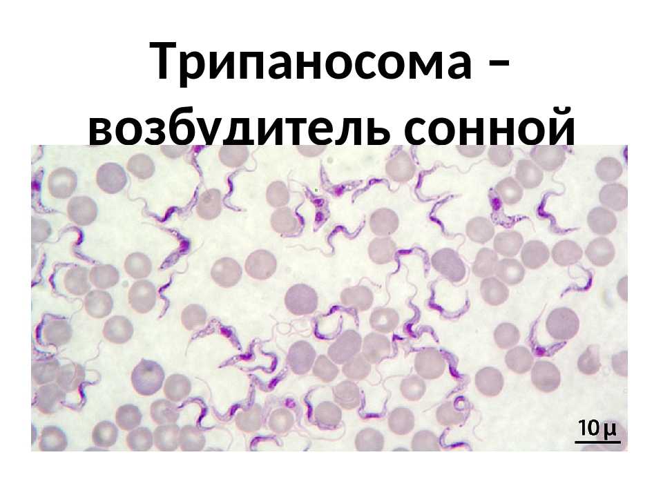 Сонная болезнь. Сонная болезнь возбудитель трипаносома. Трипаносома гамбийская заболевание. Трипаносомоз возбудитель. Трипаносома вызывает заболевание.