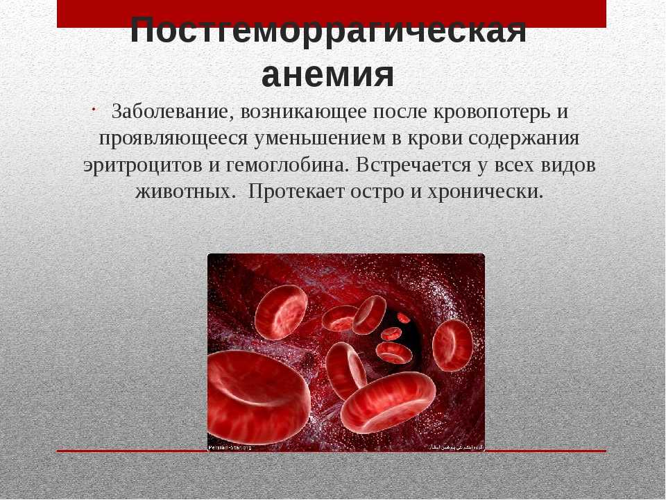 Заболевания сопровождающиеся анемией