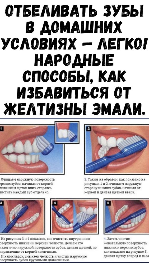 Эффективное отбеливание в домашних условиях. Как отбелить зубы в домашних условиях. Отбеливание зубов в домашних условиях. Домашние средства для отбеливания зубов. Как очистить зубы в домашних условиях.