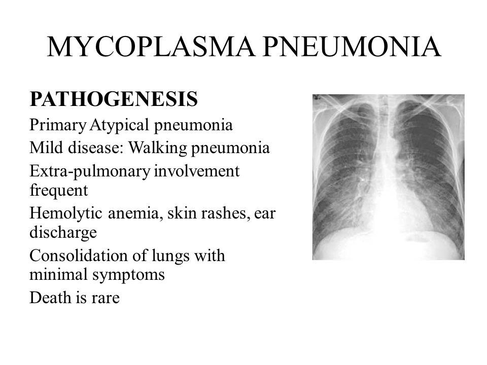 Mycoplasma pneumoniae. Atypical pneumonia. Typical atypical pneumonia. Pathogenesis of pneumonia.