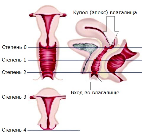 Ощущение Влага Во Влагалище