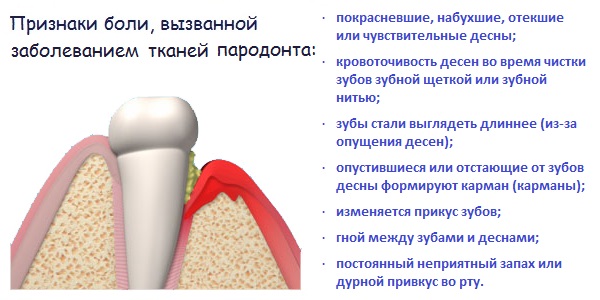 Как уменьшить боль в зубе. Заболевания тканей пародонта. Коронка на зуб под Десну.
