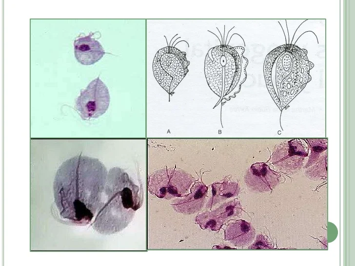 Трихомонада. Влагалищная трихомонада. Урогенитальная трихомонада. Трихомонада хоминис возбудитель.