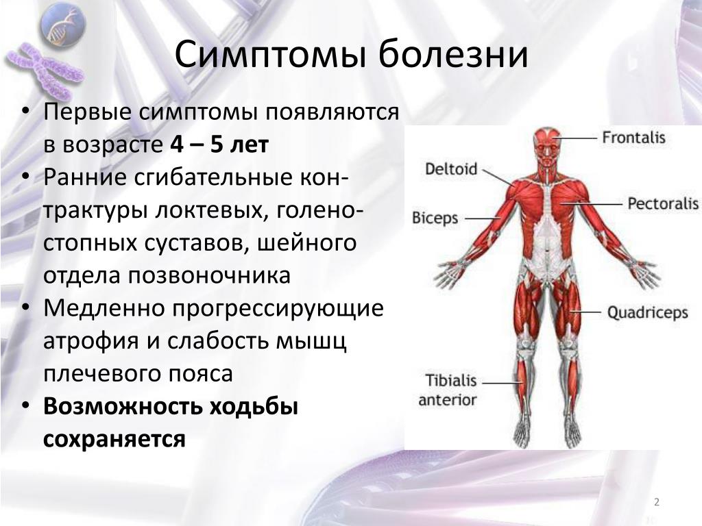 Заболевание мышц лечение
