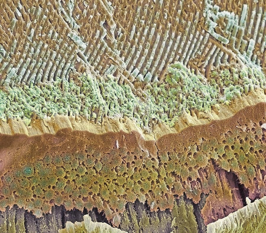 Налет на зубах под микроскопом фото для детей