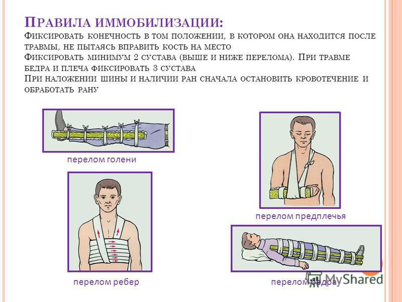 Иммобилизация это в медицине