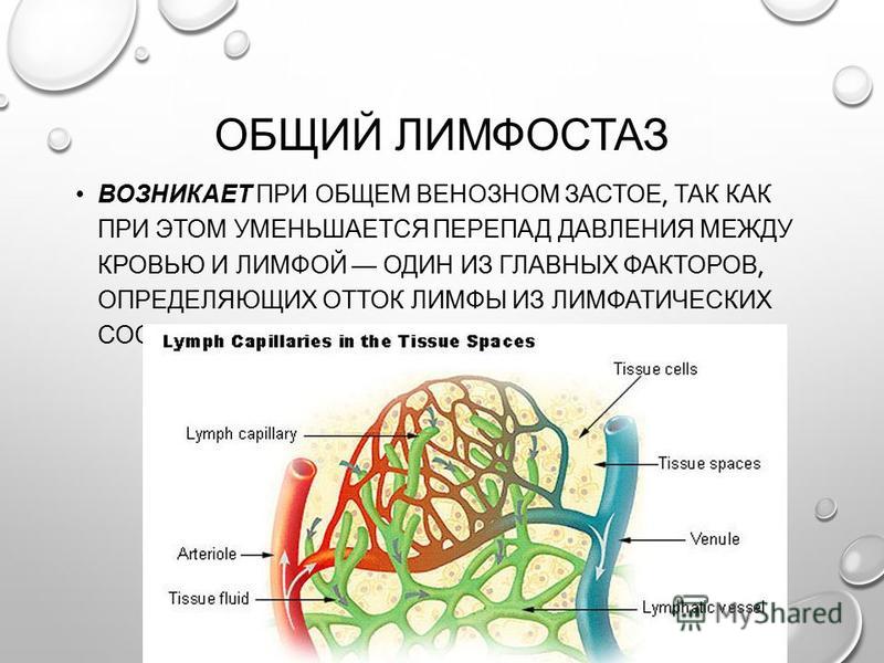 Лимфостаз Ног Картинки