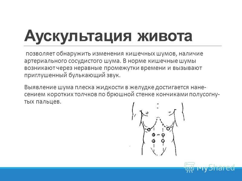 Норма жив. Аускультация брюшной полости алгоритм. Точки аускультации живота схема. Аускультация кишечника в норме. Аускультация живота пропедевтика внутренних болезней.