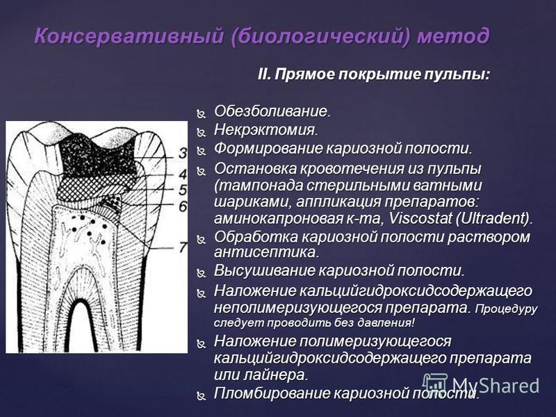 Полость средство. Метод непрямого покрытия пульпы. Прямое и Непрямое покрытие пульпы зуба. Непрямое покрытие пульпы зуба. Прямое покрытие пульпы зуба.