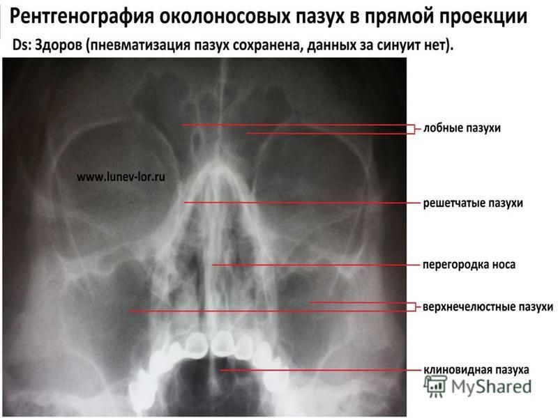 Сделать снимок пазух