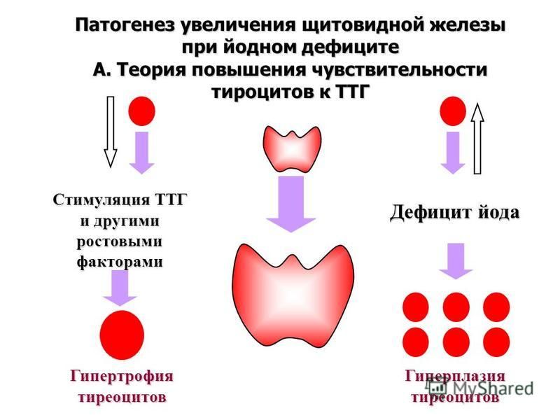 Структурные изменения щитовидной. Симптомы высокого и низкого ТТГ. Гормоны щитовидной железы патогенез. Увеличенная щитовидная железа. ТТГ щитовидной железы.