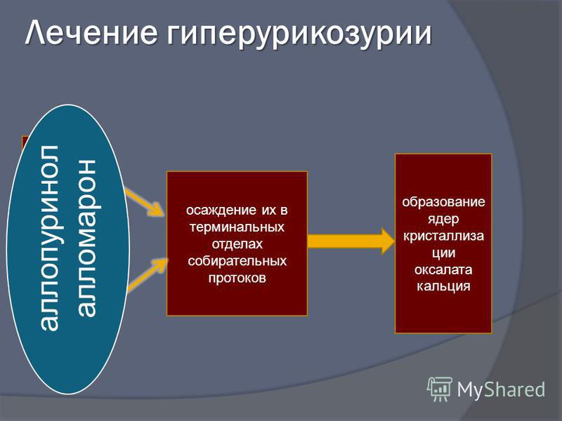 Гиперурикозурия и гиперурикемия. Гиперурикозурия.