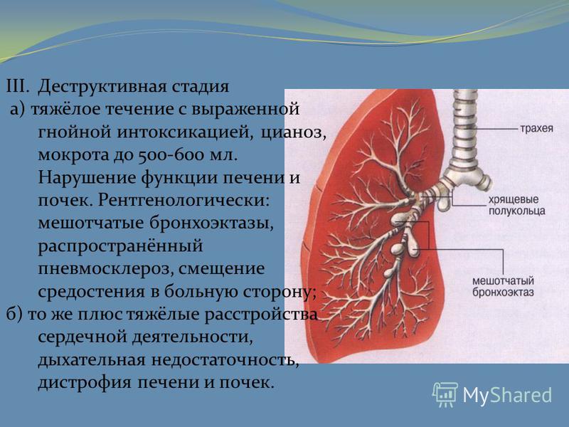 Легочный рисунок деформирован за счет пневмосклероза что это