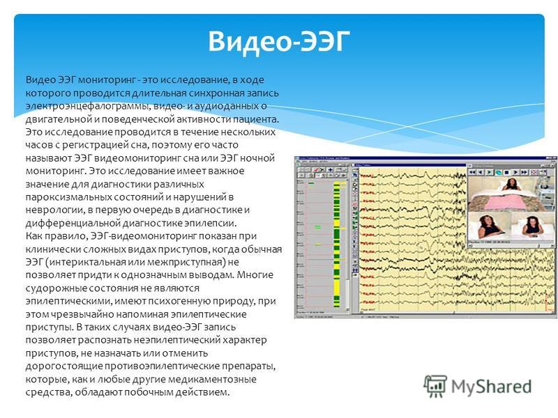 Видео ээг мониторинг. Ночной ЭЭГ мониторинг. ЭЭГ дневной мониторинг. ЭЭГ мониторинг дневной для детей.