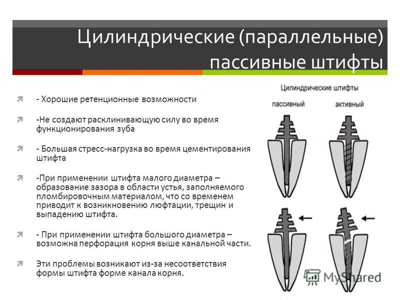 Стоимость Зуба Со Штифтом Восстановления