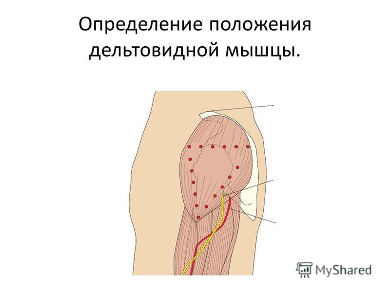 Как правильно делать укол в плечо внутримышечно фото пошагово в домашних условиях