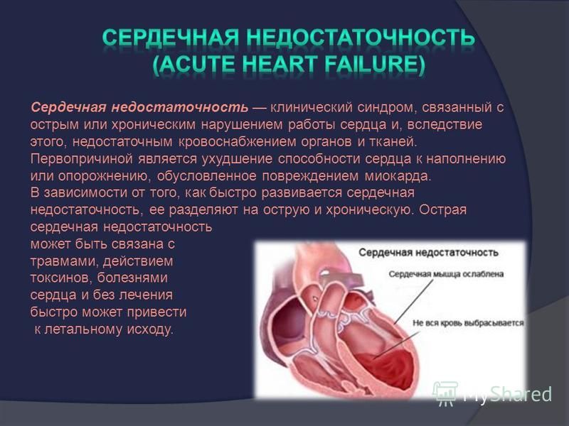 Нарушение сердечного кровообращения