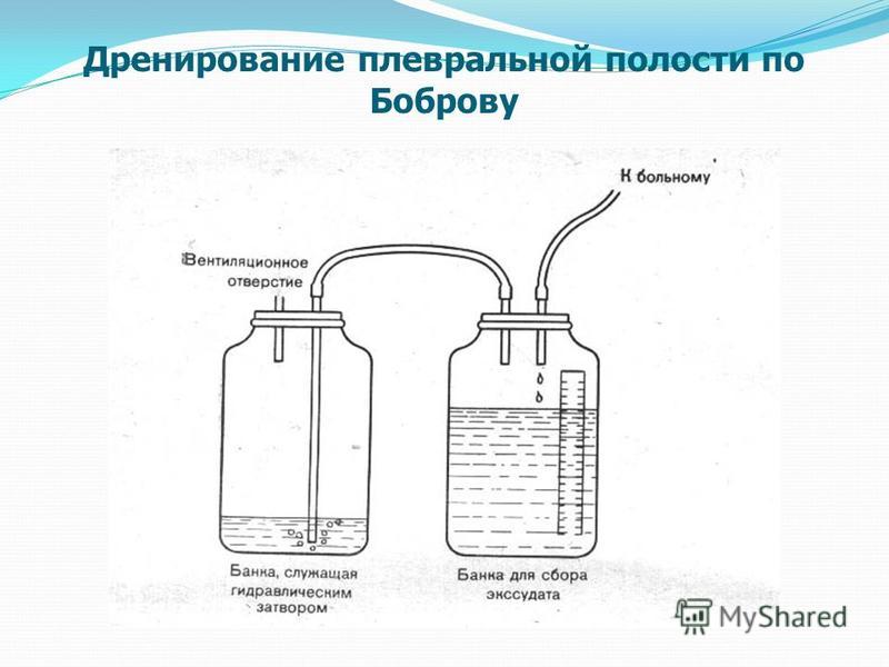 Дренирования полостей