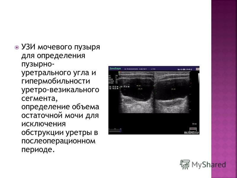 Мочевой пузырь остаточная моча норма. УЗИ протокол мочевого пузыря с остаточной мочой. Эхограммы мочевого пузыря. Объем мочевого пузыря на УЗИ норма.