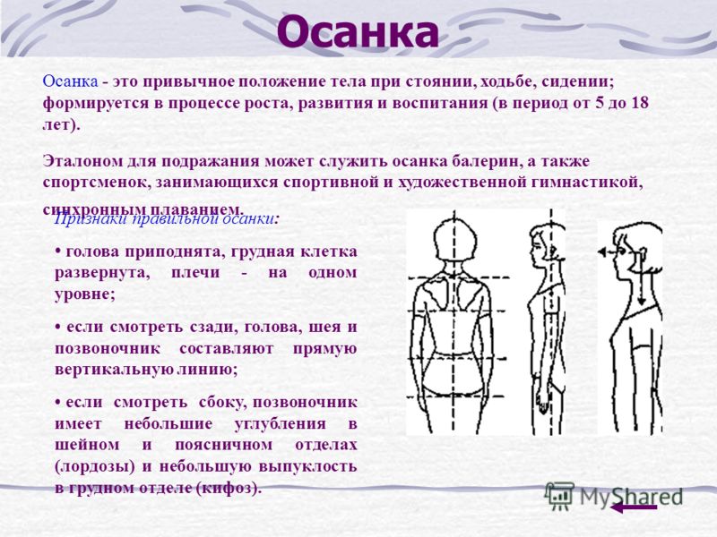 Что такое осанка. Характерные черты нормальной осанки у детей дошкольного возраста:. Краткая характеристика осанки человека. Нарушение осанки таблица. Оценить осанку у ребенка.