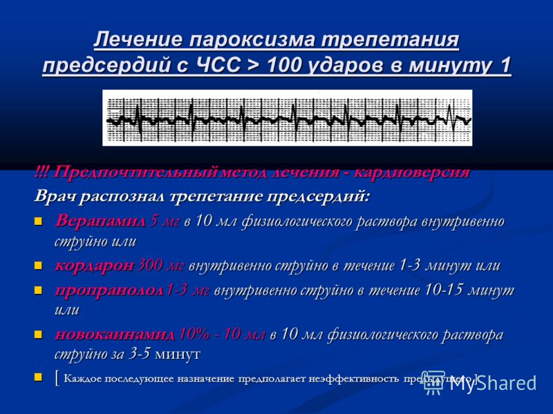 Фибрилляция предсердий это. Купирование пароксизма трепетания предсердий. Пароксизмальная форма трепетания предсердий. Фибрилляция предсердий ЧСС 100. Пароксизм фибрилляции трепетания предсердий ЭКГ.