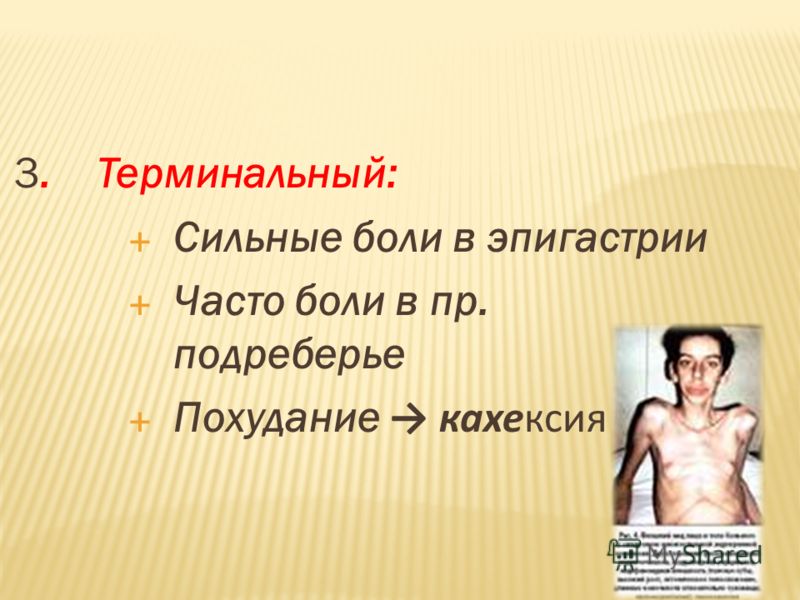 Кахексия что. Злокачественная кахексия. Раковая кахексия, истощение.