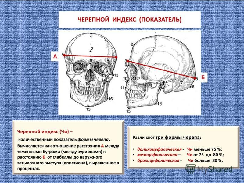 Продольный размер. Краниометрия черепа. Основные краниометрические точки мозгового черепа. Краниометрия. Черепной индекс. Лицевой индекс. Формы черепов.. Форма черепа человека сбоку.