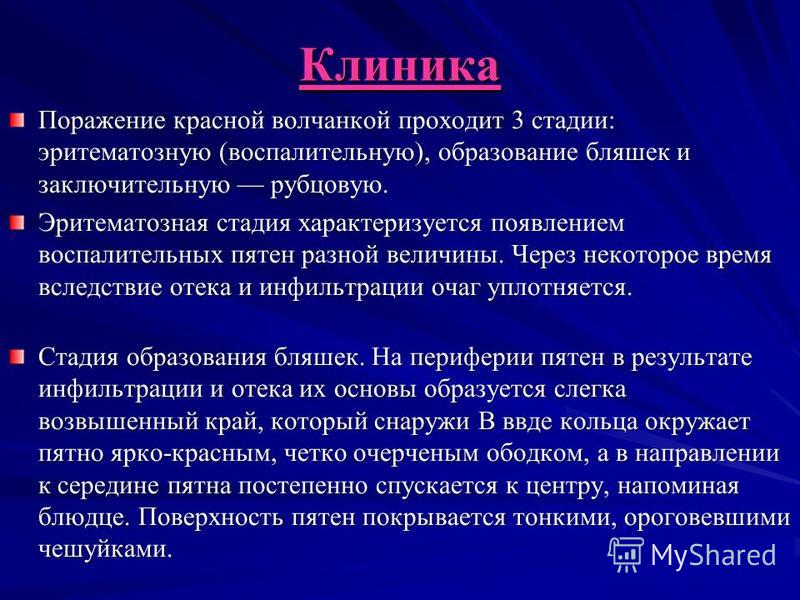 Лечение красной. Системная красная волчанка клиника. Системная острая красная волчанка клиника. Дискоидная красная волчанка клиника. Системная красная волчанка стадии.